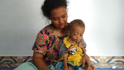 Dafa, balita pengidap gizi buruk di Cilegon
