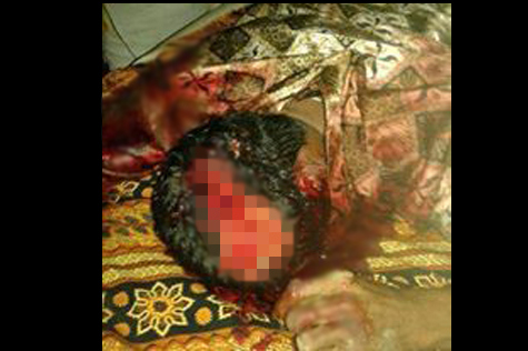 Korban-tewas-dengan-kepala-remuk