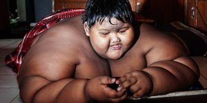 Arya Permana, anak paling gemuk sedunia.