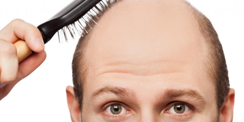 ilustrasi rambut rontok